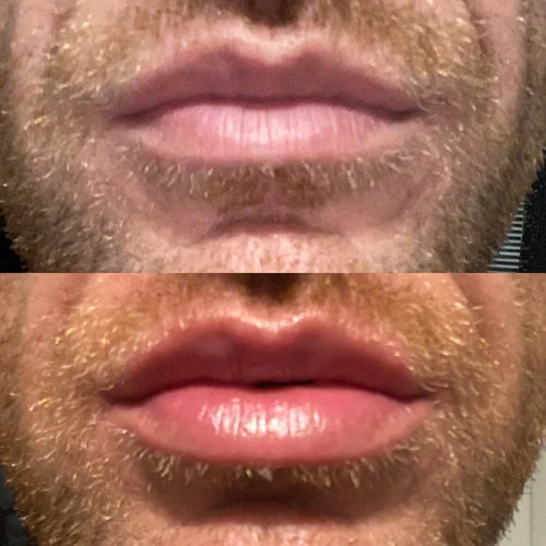 Extreme Lip Plumper