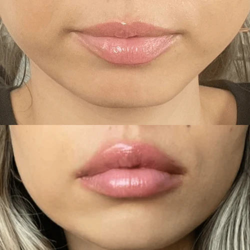 Extreme Lip Plumper