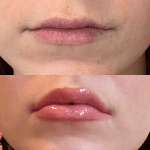 Extreme Lip Plumper