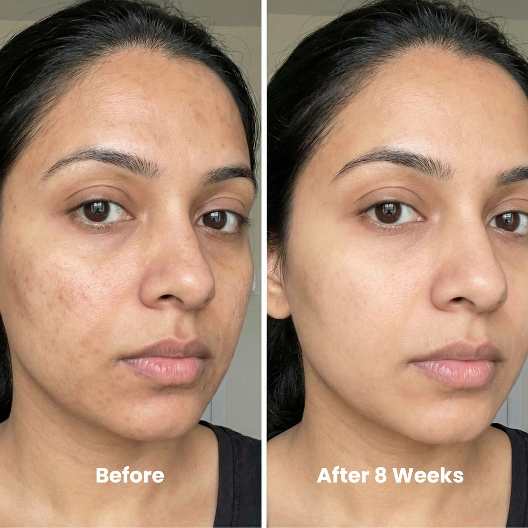 Skin Brightening & Cell Renewal Toner Pads (100 Pads)