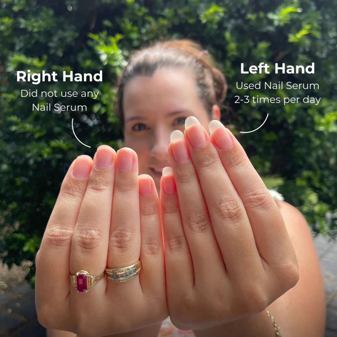 Stem Cell Nail Growth Pen