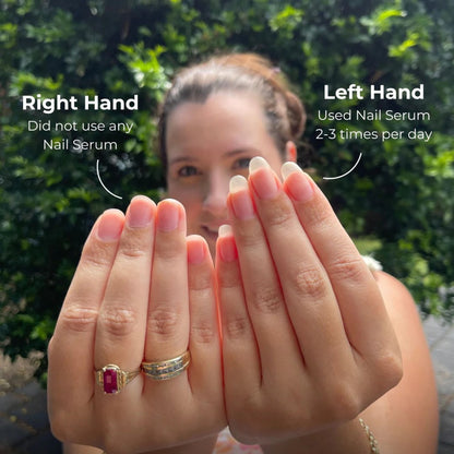 Stem Cell Nail Growth Pen