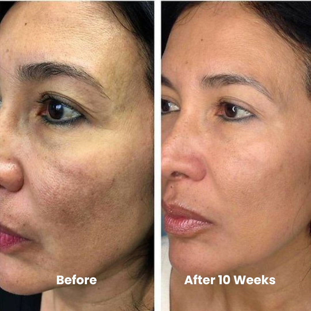 Skin Brightening & Cell Renewal Toner Pads (100 Pads)