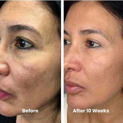 Skin Brightening & Cell Renewal Toner Pads (100 Pads)