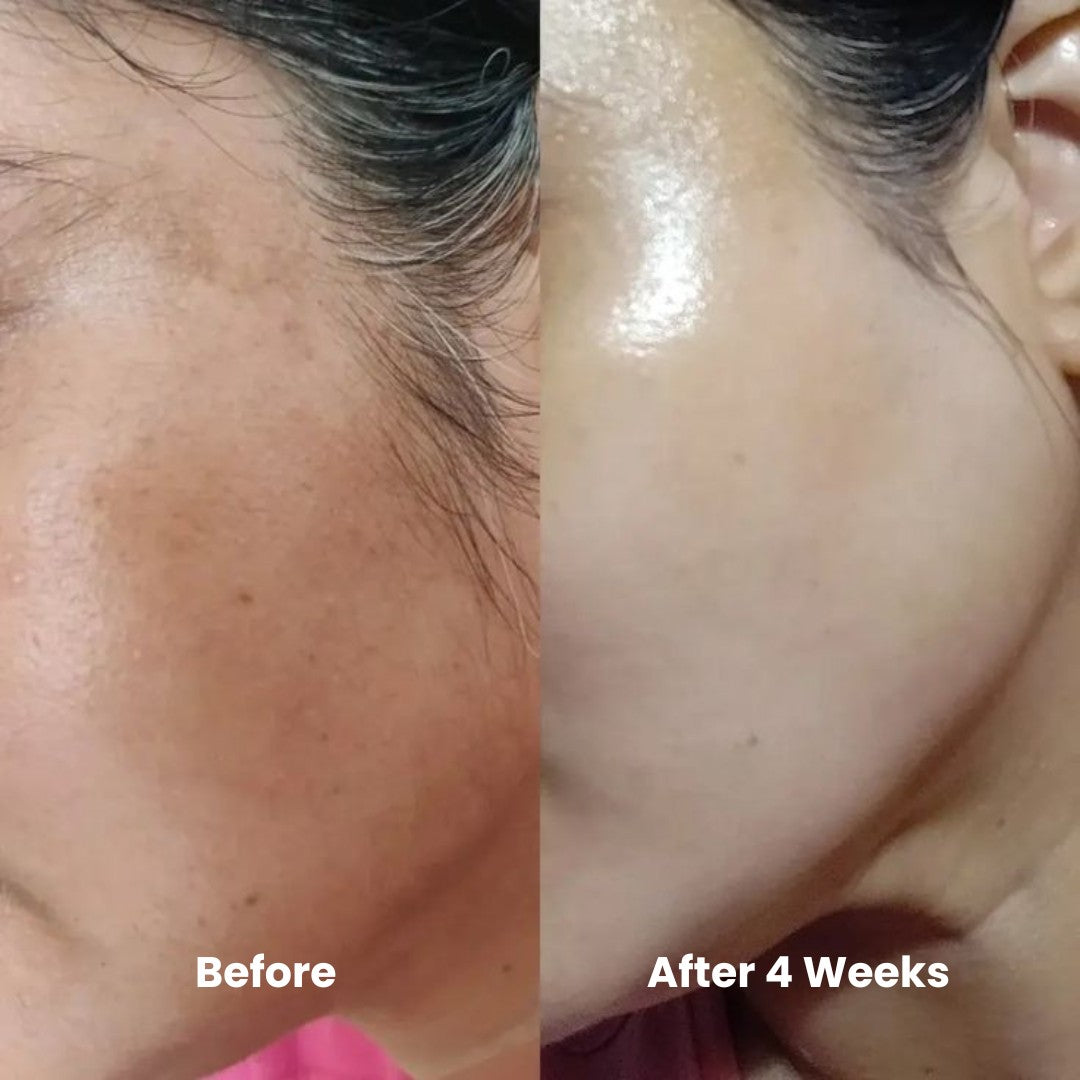 Skin Brightening & Cell Renewal Toner Pads (100 Pads)