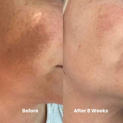 Skin Brightening & Cell Renewal Toner Pads (100 Pads)