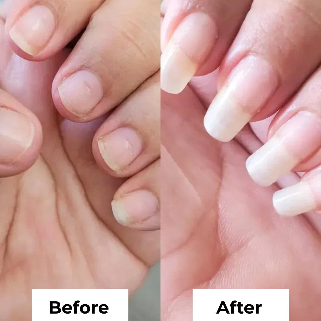 Stem Cell Nail Growth Pen