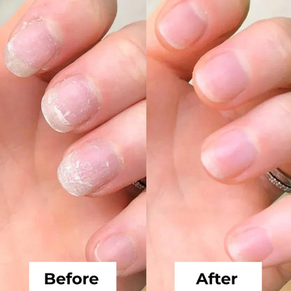 Stem Cell Nail Growth Pen