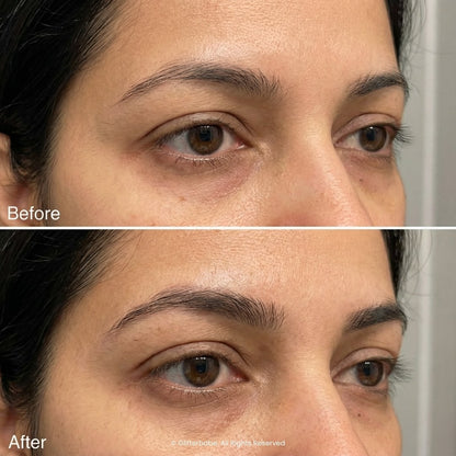 Brow & Lash Growth Serum