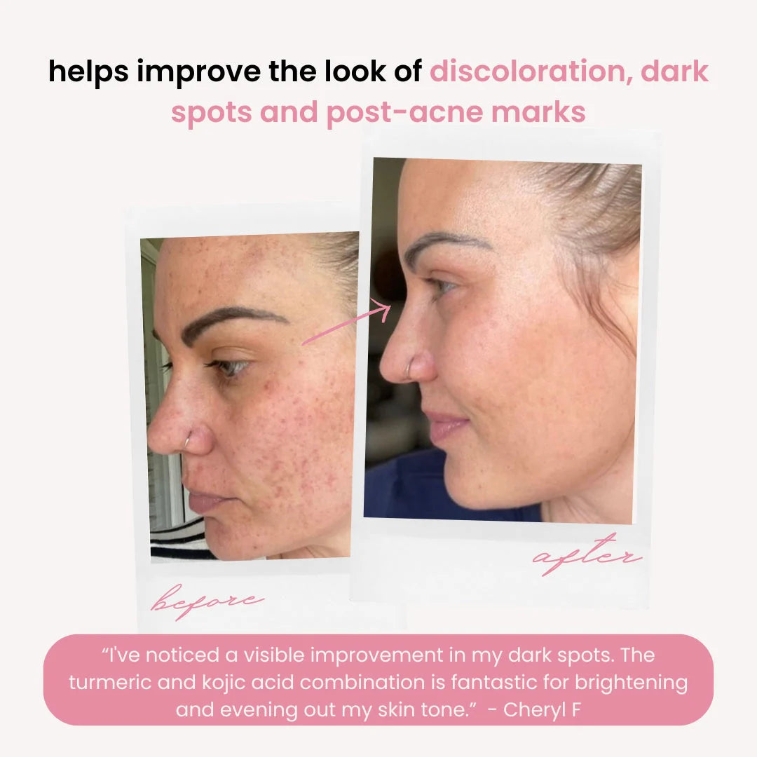 Kojic Acid & Turmeric Cleansing Pads